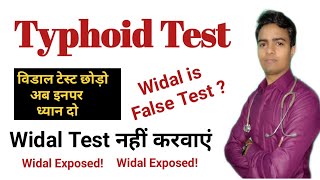 Widal Test In Hindi  Enteric Fever Test Report  विडाल टेस्ट रिपोर्ट नहीं Is False Positive test [upl. by Drofniw]