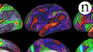 The ultimate brain map [upl. by High]