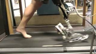 The AMPFoot 20  A Powered Transtibial Prosthesis That Mimics Intact Ankle Behavior [upl. by Roee220]