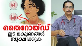 തൈറോയ്ഡ് ഈ രോഗ ലക്ഷണങ്ങൾ സൂക്ഷിക്കുക  Thyroid Malayalam Health Tips [upl. by Nylrac]