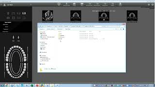 Exporting DICOM in ACTEON AIS amp Open Viewer [upl. by Ahsiele]