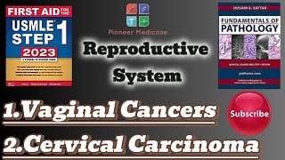 Usmle step 1Vaginal tumorsCervical carcinoma from PathomaReproductive system pathologyUrduHindi [upl. by Eilyab601]