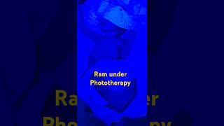 phototherapy ramराम [upl. by Dwaine267]