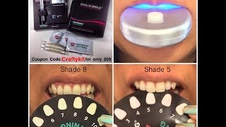 Whitening Lightning How to Whiten Your Teeth in 20 Minutes [upl. by Aleksandr138]