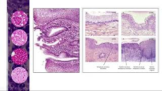 Capitulo 2 Tejido epitelial Metaplasia [upl. by Siednarb]