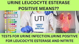 URINE EXAMINATION LEUCOCYTE ESTERASE POSITIVE UTI URINARY NITRITE AND LEUCOCYTE ESTERASE POSITIVE [upl. by Couq]