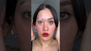 Sharing one of my fav videos as a reminder that no skin is bad 🤍 vitiligo acne poliosis skin [upl. by Scott]