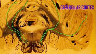 Purkinje cells in the cerebellum [upl. by Ianthe]