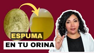 ELIMINA la espuma de tu orina porque tu orina tiene espuma 😨 [upl. by Hurty]