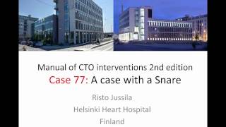 Case 77 Manual of CTO Interventions  Wire snaring and externalization [upl. by Hirst449]