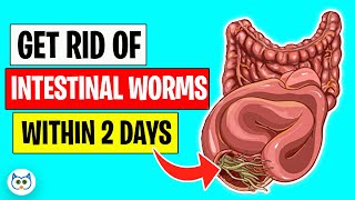 Use These Natural Methods To Get Rid of Intestinal Worms Within Two Days [upl. by Inait754]