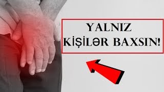 Kişilərin Başının Bəlası  PROSTAT XƏSTƏLİYİNİN MÜALİCƏSİ [upl. by Evad]