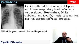 internalmedicine cme usmle محاضراتباطنة ecg كورساتباطنة clinical clinical medicine [upl. by Ojillib179]