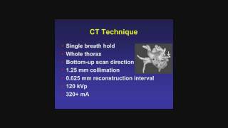 Pre Ablation Cardiac CT [upl. by Wanonah]