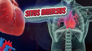 Ocular Manifestations of Situs Inversus [upl. by Haeli703]