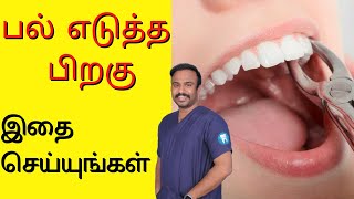 பல் எடுத்த பிறகு இதைச் செய்யுங்கள்  What to do After Tooth Removal  Tamil [upl. by Jeremy258]