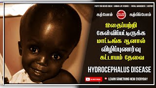 இதைப்பற்றி கேள்விபற்றுக்கமாட்டீங்க ஆனால் விழிப்புணர்வு கட்டாயம் தேவை  Hydrocephalus in Tamil [upl. by Kylah818]