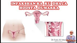 INFAKSHANKA KU DHACA XUBINKA TARANKA DUMARKA IYO SIDA LOO DAAWEEYO Dr faris [upl. by Zeeba454]