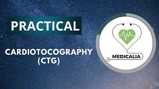 Cardiotocography  CTG   part 2 [upl. by Susej]