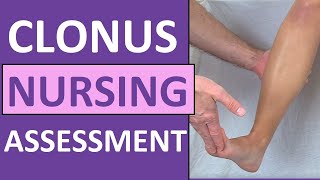 Clonus Test Positive Reflex Sign Preeclampsia Pregnancy  Nursing Skills [upl. by Bushweller]