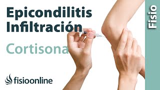 Epicondilitis o codo de tenista y las infiltraciones de cortisona o corticoides [upl. by Lihkin]