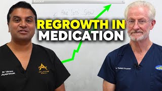 Percentage Regrowth in Hair Loss Medication [upl. by Anivlek364]