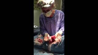 Removing obstructive material from a dogs stomach [upl. by Denna]