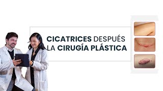 Tipos de cicatrices después de la cirugía plástica 👩🏻‍⚕️ [upl. by Aniroc]