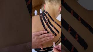 Lymphatic correction in the acute stage after cervical spine contusion [upl. by Naaitsirhc142]