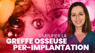 Simplifier la greffe osseuse perimplantaire [upl. by Lacram]