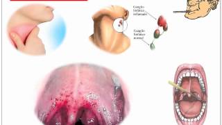 Streptococcus Pyogenes [upl. by Naivad]