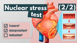 Nuclear stress test Tracers interpretation and indications 22 [upl. by Nnyllatsyrc]