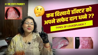 कब दिखाये डॉक्टर को अपने सफेद दाग धब्बे  Types of LEUKOPLAKIA… [upl. by Ramraj]