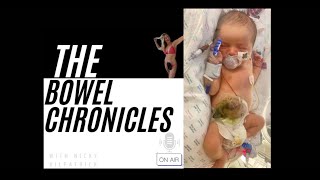 Miracles amp Strength A Mother’s journey through her newborn’s stoma surgery [upl. by Laveen]