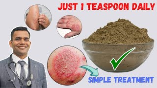 Just 1 Teaspoon Daily To Cure all Your Skin Problems  Eczema  Simple Treatment [upl. by Raddie219]