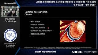 Sesión ReglamentariaLesión de BankartCarril glenoideo y lesión de HillSachs quoton trackquot  quotof tra [upl. by Mehala672]