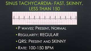 Breaking Down BASIC Dysrhythmias [upl. by Noleta]