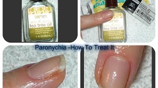 Acute Chronic PARONYCHIA Treatments [upl. by Anaxor918]