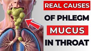 The Real Causes of Constant PHLEGM amp MUCUS In Your Throat [upl. by Miles]