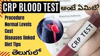 CRP Blood Test in Telugu అధిక సిరియాక్టివ్ ప్రోటీన్ CRP యొక్క కారణాలు amp లక్షణాలు [upl. by Aicenaj]