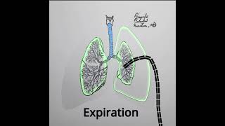 Pneumothorax Treatment Animation variation 4 shorts medical [upl. by Edrahs]