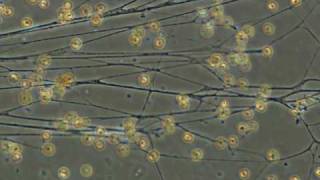 foraminiferal rhizopodia [upl. by Huda]