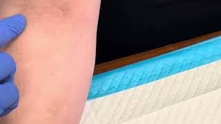 3 Tips For Locating DIFFICULT Veins  Phlebotomy Tip  Medical Assistant Training [upl. by Chladek802]