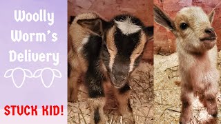 Woolly Worms KiddingBirth STUCK KID Head amp 1 Leg Forward 1 Leg Back Nigerian Dwarf Doe Goat [upl. by Onaivlis]