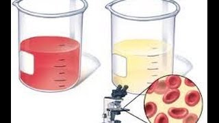 Hematuria [upl. by Purdy]