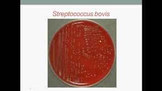 Bacteriology Streptococcus Gram Positive Cocci [upl. by Godfrey]