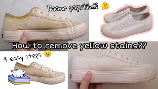 How to remove yellow stains on white shoes 4 Easy Steps [upl. by Lyrahc]