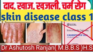 skin diseaseskin careचर्म रोग जड़ से खत्म medicinefungal infection Eczema psoriasis treatment [upl. by Saoj]