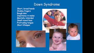 Chromosomal disorders [upl. by Styles835]