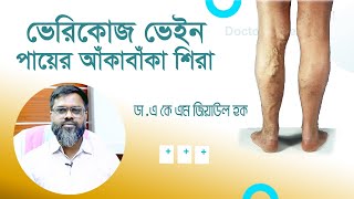 পায়ের আঁকাবাঁকা শিরা রোগের চিকিৎসা  ভেরিকোজ ভেইন  Varicose Veins Treatment  Bangla Health Tips [upl. by Liss]